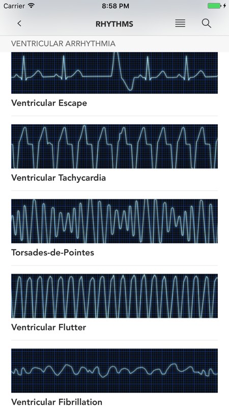 Instant ECG 截图