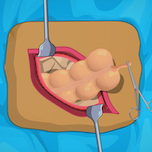 Appendix Surgery