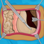 Stomach Surgery