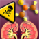 Kidney Bounce
